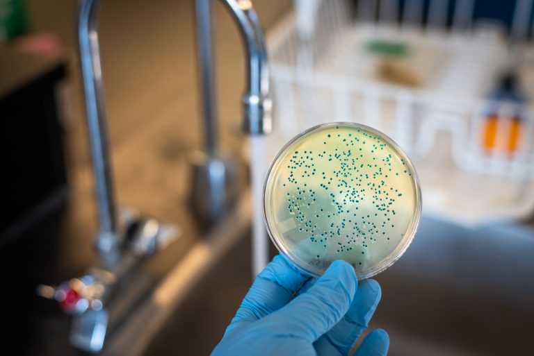 microbioma dell'alveare